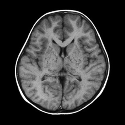 図3:核磁気共鳴画像(MRI)
